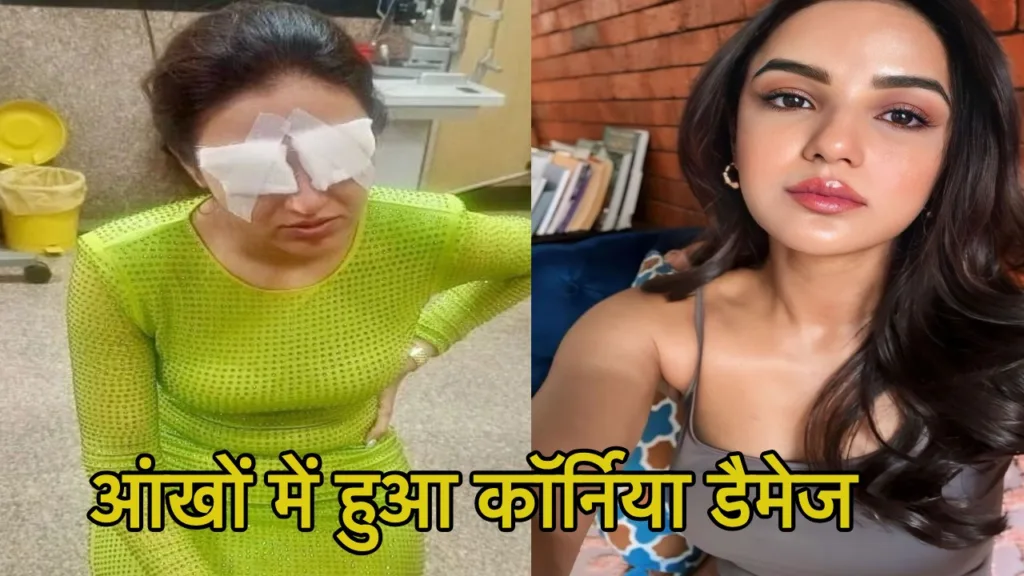 लेंस लगाने के बाद जलने लगीं Jasmine Bhasin की आंखें, लेट नाईट घंटों दर्द से तड़पी एक्ट्रेस
