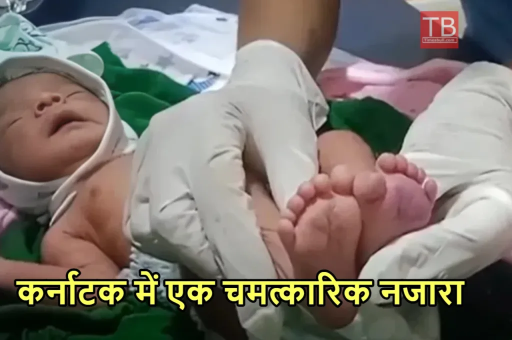 25 अंगुली लेकर पैदा हुआ बच्चा तो डॉक्टर के उड़े होश, खुशी से झूमे पिता ने खोला बड़ा राज