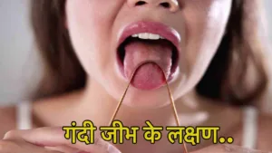 Featured image for: Health Care Tips:  मुंह की बदबू और बीमारियों से करें बचाव, जान ले आखिर क्यों जरूरी है जीभ साफ करना! in Health category