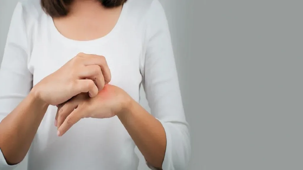 Dyshidrosis on Hands and Feet: What is Dyshidrotic Eczema and How to Treat It