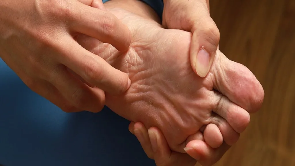 Itchy feet: discover the causes and remedies