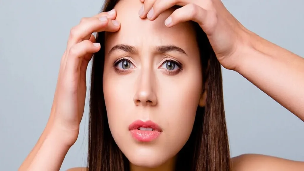 Pimples on Forehead: Causes, Treatment and Prevention