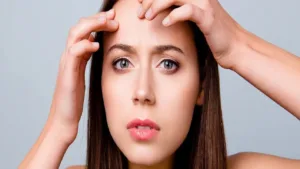 Featured image for: Pimples on Forehead: Causes, Treatment and Prevention in Health category