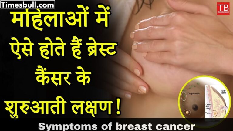 These are the early symptoms of breast cancer in women